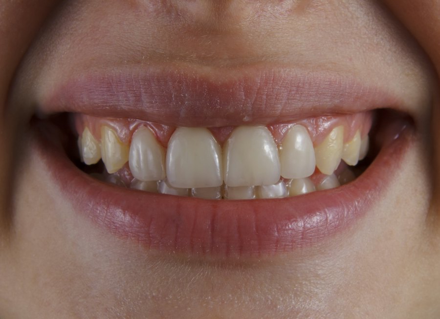 Smile correction before (sample)