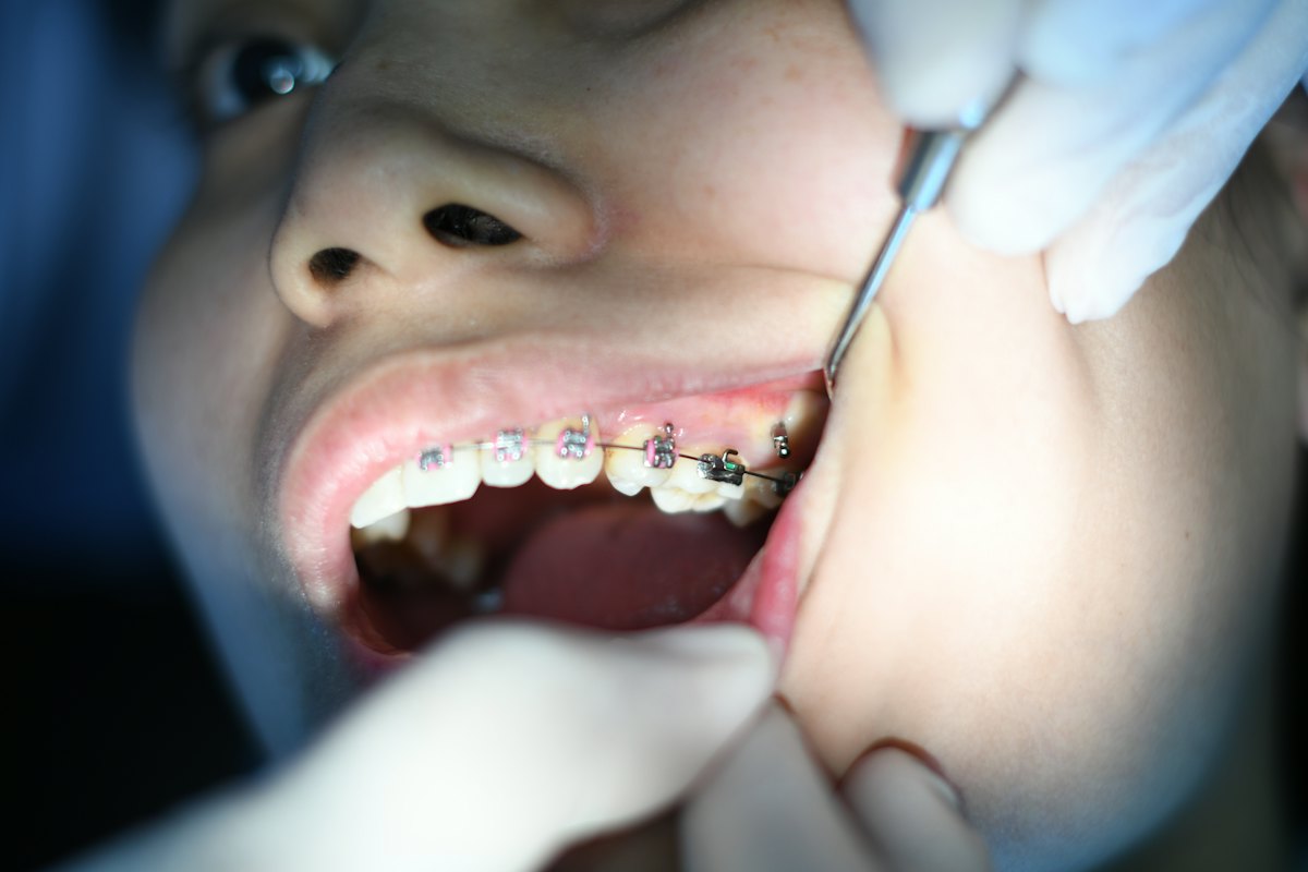 Braces & Alignment Consultation in Shrigonda