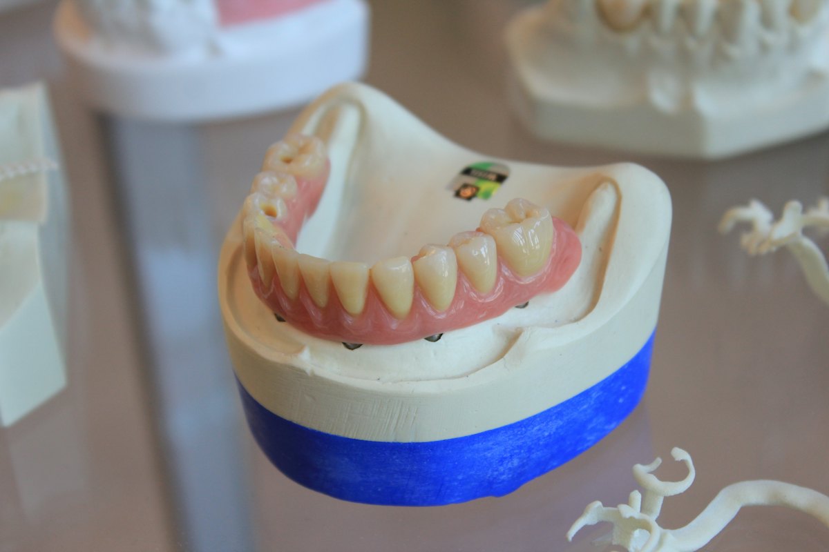 Dentures & Crowns in Shrigonda