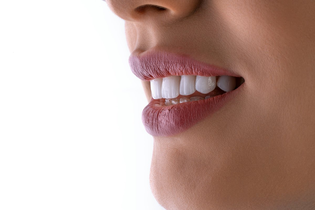 Teeth Whitening in Shrigonda